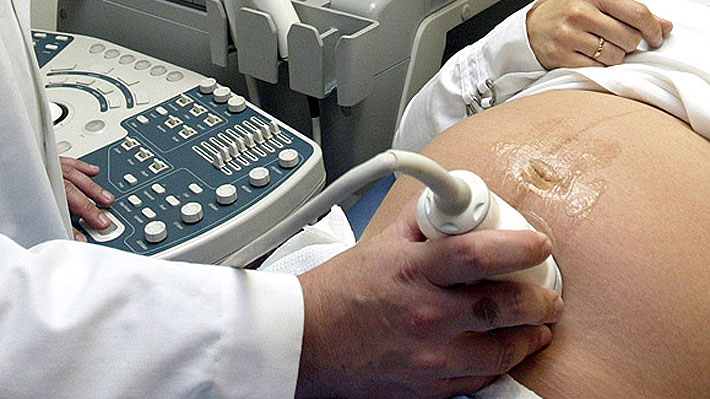 62,5% de lectores respalda idea de oir latido fetal antes del aborto